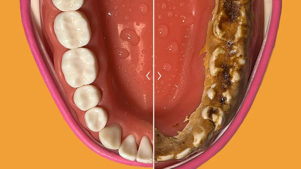 9 نصائح بعد تنظيف الأسنان من الجير